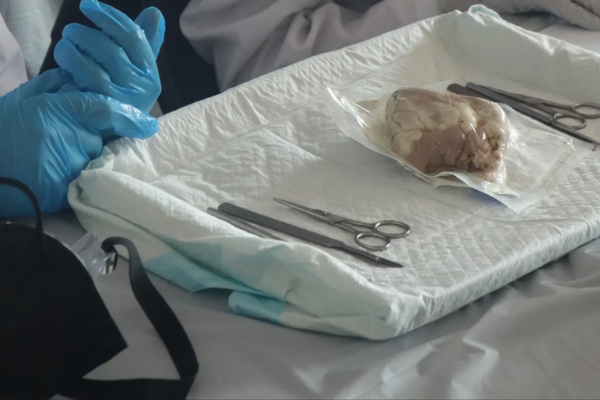 Health Dissection Health Skills CE