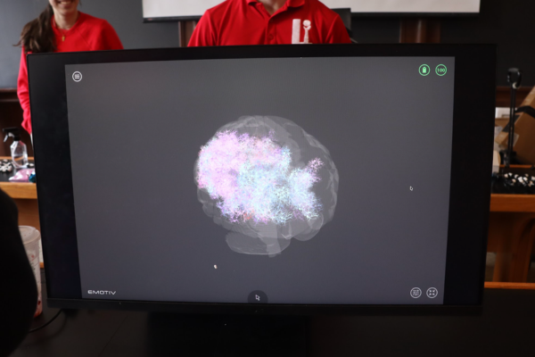 Neuro S2 EEG Pic