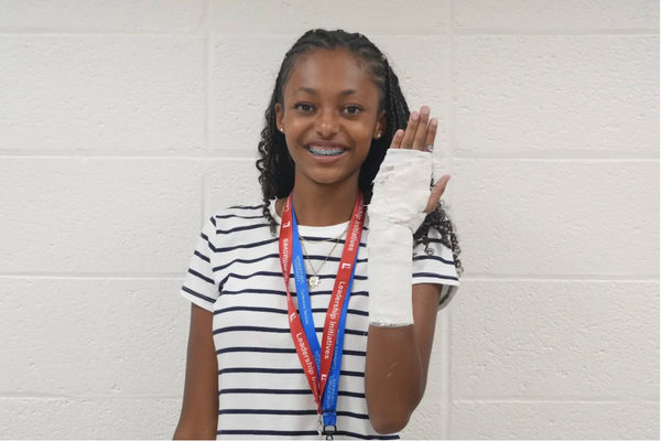 S1 Med Kalani Bond casting 1
